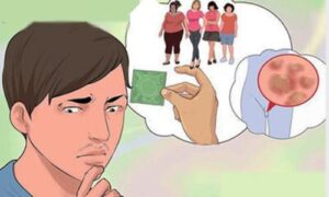Quan hệ không dùng bao cao su có sao không?