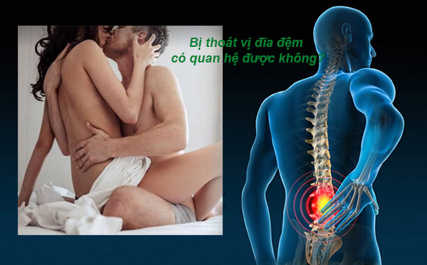 bị thoát vị đĩa đệm có quan hệ được không và các tư thế quan hệ nào