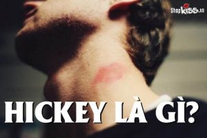 Hickey là gì?