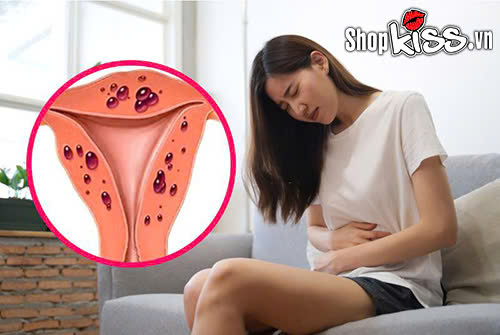Buồn nôn sau khi quan hệ - Nguyên nhân do đâu? 2 Buồn nôn sau khi quan hệ có sao không?