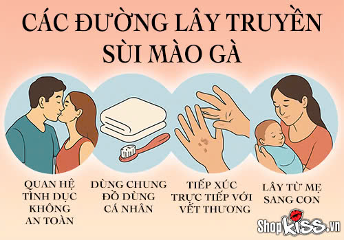 Chuyên gia giải đáp: Ngủ chung có lây sùi mào gà không? 5 Vợ chồng ngủ chung có lây sùi mào gà không?