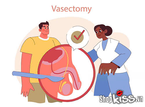 Bác sĩ giải đáp: Thắt ống dẫn tinh có quan hệ được không? 3 Nam giới thắt ống dẫn tinh có quan hệ được không?
