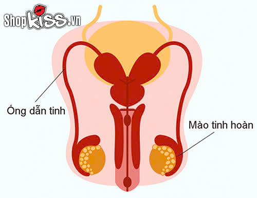 Bác sĩ giải đáp: Thắt ống dẫn tinh có quan hệ được không? 2 Phương pháp thắt ống dẫn tinh có quan hệ được không?