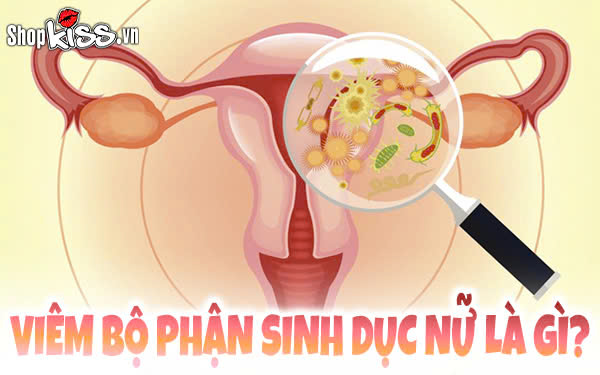 Viêm bộ phận sinh dục nữ là gì?
