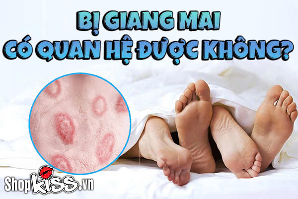 Bị giang mai có quan hệ được không? Giải đáp từ A–Z 1 Bị giang mai có quan hệ được không?