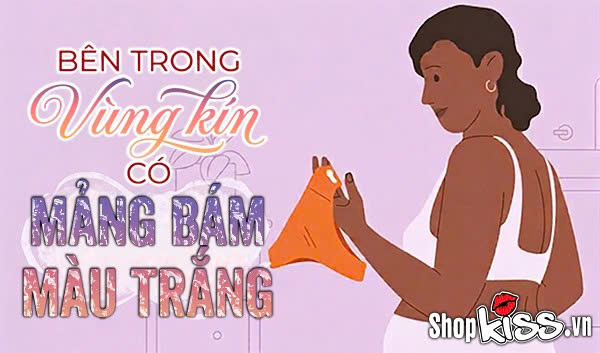 Bên trong vùng kín có mảng bám màu trắng