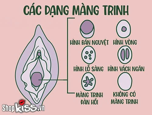 Quan hệ bằng tay có rách màng trinh không? Bác sĩ giải đáp 2 Còn trinh quan hệ bằng tay có rách màng trinh không?
