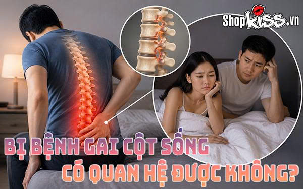 Bị bệnh gai cột sống có quan hệ được không? Cách "yêu" an toàn 1 Bị bệnh gai cột sống có quan hệ được không?