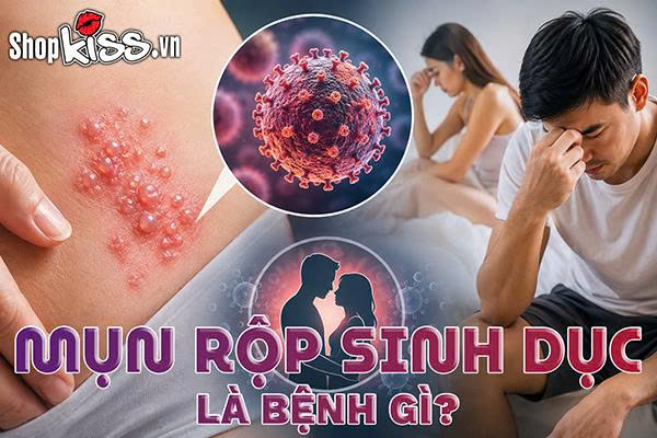 Mụn rộp sinh dục là bệnh gì?