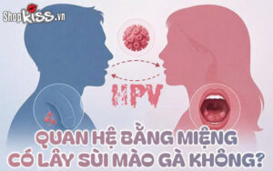 Quan hệ bằng miệng có lây sùi mào gà không?